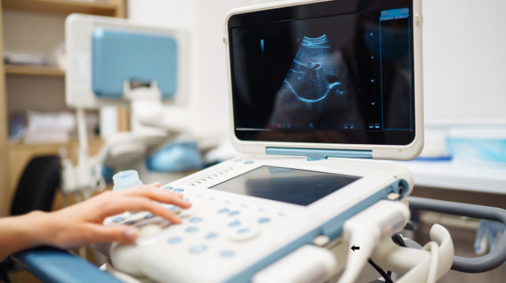 A healthcare professional operates an ultrasound machine displaying a sonogram image on the monitor.